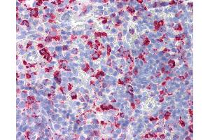 Anti-CD68 antibody IHC of rat spleen. (CD68 anticorps)