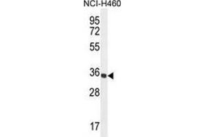 Western blot analysis in NCI-H460 cell line lysates (35ug/lane) using Trypsin-1 / PRSS1  Antibody . (PRSS1 anticorps  (Middle Region))