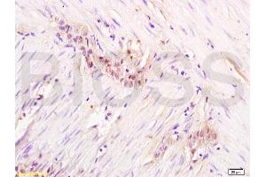 Formalin-fixed and paraffin embedded rat colon labeled with Anti-Gemin 2 Polyclonal Antibody, Unconjugated  at 1:200 followed by conjugation to the secondary antibody and DAB staining. (SIP1 anticorps  (AA 51-150))