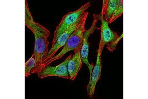 Immunofluorescence analysis of HeLa cells using SPIB mouse mAb (green).