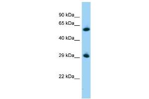 WB Suggested Anti-Zbtb7a Antibody   Titration: 1. (ZBTB7A anticorps  (C-Term))