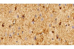 Detection of S100B in Bovine Cerebrum Tissue using Polyclonal Antibody to S100 Calcium Binding Protein B (S100B)