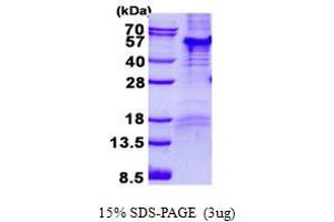 Image no. 1 for Par-6 Partitioning Defective 6 Homolog beta (PARD6B) (AA 1-372) protein (His tag) (ABIN6387086)