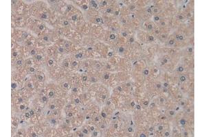 Detection of PCPE2 in Human Liver Tissue using Polyclonal Antibody to Procollagen C Proteinase Enhancer 2 (PCPE2)