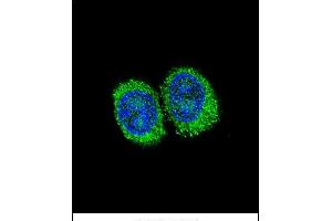Confocal immunofluorescent analysis of NPC1 Antibody (Center) (ABIN657395 and ABIN2846435) with 293 cell followed by Alexa Fluor 488-conjugated goat anti-rabbit lgG (green).