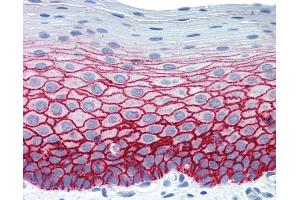 Anti-SDC1 / Syndecan 1 / CD138 antibody IHC staining of human tonsil.