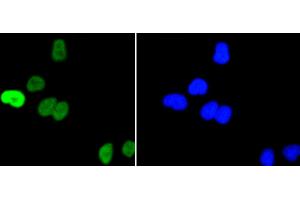 HeLa cells were stained with c-Myc(S62) (1A7 ) Monoclonal Antibody (b at [1:200] incubated overnight at 4C, followed by secondary antibody incubation, DAPI staining of the nuclei and detection. (c-MYC anticorps  (pSer62))