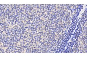 Detection of Bid in Human Lymph node Tissue using Polyclonal Antibody to BH3 Interacting Domain Death Agonist (Bid) (BID anticorps  (AA 1-195))
