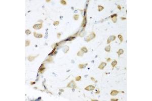 Immunohistochemistry of paraffin-embedded mouse brain using EL antibody (ABIN6134649, ABIN6140114, ABIN6140116 and ABIN6221621) at dilution of 1:200 (40x lens).