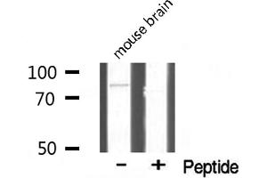 Western blot analysis of TBX3 expression in mouse brain lysate (TBX3 anticorps)