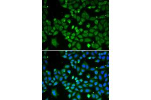 Immunofluorescence analysis of A549 cell using ECI1 antibody.