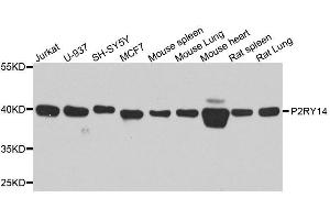Western blot analysis of extracts of various cell lines, using P2RY14 antibody. (P2RY14 anticorps  (AA 209-338))