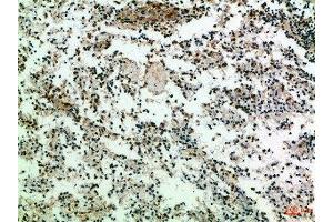 Immunohistochemical analysis of paraffin-embedded Human-spleen, antibody was diluted at 1:100