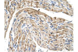 FADS1 antibody was used for immunohistochemistry at a concentration of 4-8 ug/ml to stain Skeletal muscle cells (arrows) in Human Muscle. (FADS1 anticorps  (C-Term))