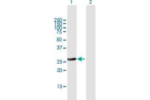Western Blot analysis of RAB32 expression in transfected 293T cell line by RAB32 MaxPab polyclonal antibody. (RAB32 anticorps  (AA 1-225))