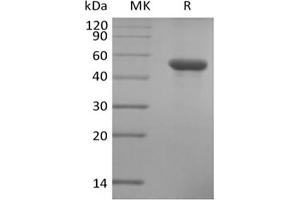 Immunoglobulin-Like Domain Containing Receptor 2 (ILDR2) protein (His tag)