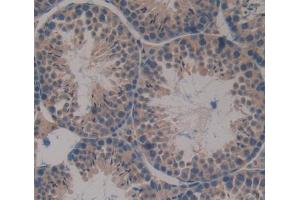 Used in DAB staining on fromalin fixed paraffin- embedded Kidney tissue (DHPS anticorps  (AA 1-369))