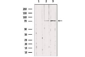 Western blot analysis of extracts from various samples, using NYREN18 Antibody.