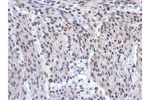 IHC-P Image hnRNP F antibody [N1N3] detects hnRNP F protein at nucleus on mouse uterus by immunohistochemical analysis. (HNRNPF anticorps)