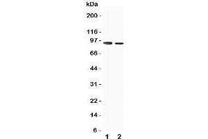 Western blot testing of SLC9A2 antibody and Lane 1:  rat skeletal musle;  2: rat kidney tissue lysate. (SLC9A2 anticorps  (C-Term))