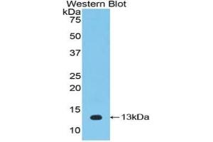 WB of Protein Standard: different control antibodies against Highly purified E. (IL-33 Kit ELISA)