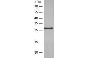 Western Blotting (WB) image for Macrophage Inflammatory Protein Related Protein 1 (MRP1) (AA 1248-1531) protein (His tag) (ABIN7123821) (MRP1 Protein (AA 1248-1531) (His tag))