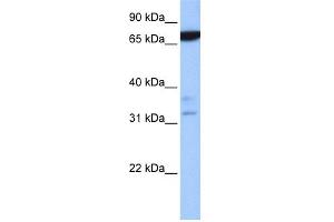 WB Suggested Anti-ZBTB46 Antibody Titration:  0. (ZBTB46 anticorps  (N-Term))