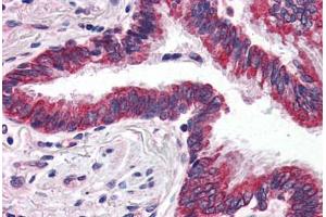 Human Lung (formalin-fixed, paraffin-embedded) stained with GRIK1 antibody ABIN343897 at 5 ug/ml followed by biotinylated goat anti-rabbit IgG secondary antibody ABIN481713, alkaline phosphatase-streptavidin and chromogen. (GRIK1 anticorps  (C-Term))