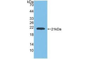 Western blot analysis of recombinant Rat GaA. (GAA anticorps  (AA 70-225))