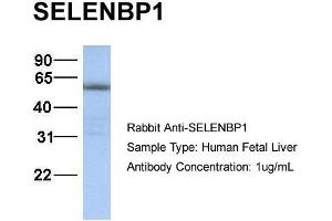 WB Suggested Anti-SELENBP1 antibody Titration: 1 ug/mL Sample Type: Human liver (SELENBP1 anticorps  (N-Term))