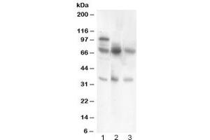 Western blot testing of GAD67 antibody and Lane 1:  rat brain