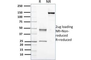 Purified Nucleophosmin-Monospecific Mouse Monoclonal Antibody (NPM1/3398). (NPM1 anticorps  (AA 185-287))