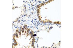 Immunohistochemistry of paraffin-embedded rat lung using C8orf4 antibody at dilution of 1:100 (40x lens). (C8orf4 anticorps)