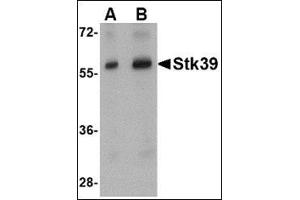 Western blot analysis of Stk39 in rat brain tissue lysate with this product at (A) 1 and (B) 2 μg/ml. (STK39 anticorps  (Center))
