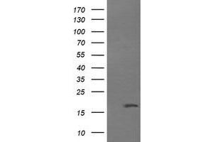 Image no. 1 for anti-Cancer/testis Antigen 1B (CTAG1B) antibody (ABIN1499902) (CTAG1B anticorps)