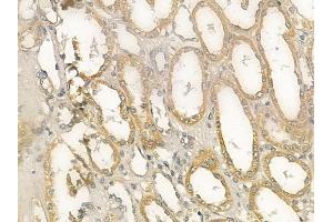 ABIN6259275 and ABIN6273382 at 1/100 staining human normal kidney tissue by IHC-P. (PDHA2 anticorps  (C-Term))