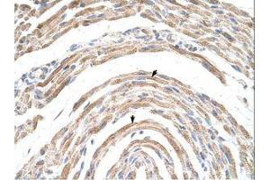 Image no. 1 for anti-Cleavage and Polyadenylation Specific Factor 6, 68kDa (CPSF6) (AA 261-310) antibody (ABIN202751)