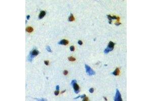 Immunohistochemistry (IHC) image for anti-NUDC antibody (ABIN7308104) (NUDC anticorps)