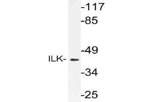 Western blot (WB) analysis of ILK antibody in extracts from rat liver cells. (ILK anticorps)