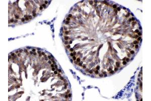 CACYBP was detected in paraffin-embedded sections of rat testis tissues using rabbit anti- CACYBP Antigen Affinity purified polyclonal antibody (Catalog # ) at 1 µg/mL.