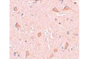 Immunohistochemical staining of human brain tissue with 5 ug/mL SIPA1L1 polyclonal antibody . (SIPA1L1 anticorps  (N-Term))