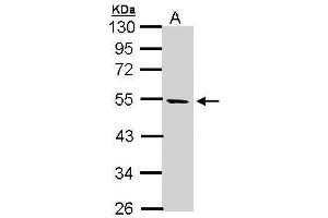 WB Image Sample (30 ug of whole cell lysate) A: Hela S3 10% SDS PAGE antibody diluted at 1:1000 (STK25 anticorps)