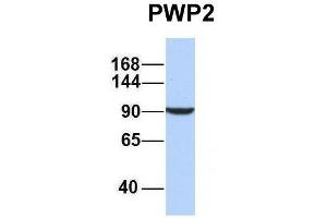 Host:  Rabbit  Target Name:  PWP2  Sample Type:  MCF7  Antibody Dilution:  1. (PWP2 anticorps  (Middle Region))