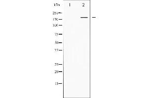 Western blot analysis of PPAR-BP phosphorylation expression in Serum treated HuvEc whole cell lysates,The lane on the left is treated with the antigen-specific peptide. (MED1 anticorps  (pThr1457))