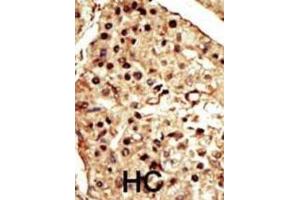 Immunohistochemistry (IHC) image for anti-Transient Receptor Potential Cation Channel, Subfamily M, Member 7 (TRPM7) antibody (ABIN2995271) (TRPM7 anticorps)