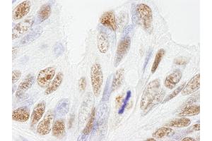 Immunohistochemistry (IHC) image for anti-Nuclear Mitotic Apparatus Protein 1 (NUMA1) (AA 900-950) antibody (ABIN7448994) (NUMA1 anticorps  (AA 900-950))