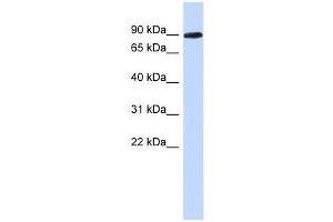 PGM2L1 antibody used at 1 ug/ml to detect target protein. (PGM2L1 anticorps  (N-Term))