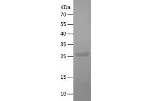 Western Blotting (WB) image for GID Complex Subunit 8 Homolog (GID8) (AA 1-228) protein (His tag) (ABIN7123082)