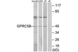 Western Blotting (WB) image for anti-G Protein-Coupled Receptor, Family C, Group 5, Member B (GPRC5B) (AA 61-110) antibody (ABIN2890862) (GPRC5B anticorps  (AA 61-110))