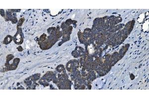 IHC analysis of MAP4K5 using anti-MAP4K5 antibody (ABIN7603181). (MAP4K5 anticorps  (N-Term))